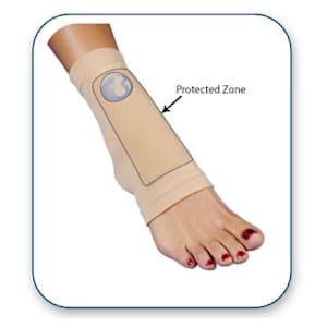 Bunga Pad Lace Bite Foot Pad - Senior